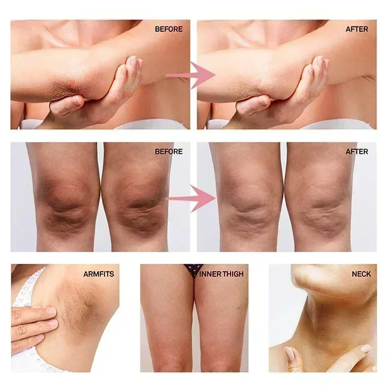 Collagen underarm whitening cr - Anti-Aging Face Cream ulasan dan harga