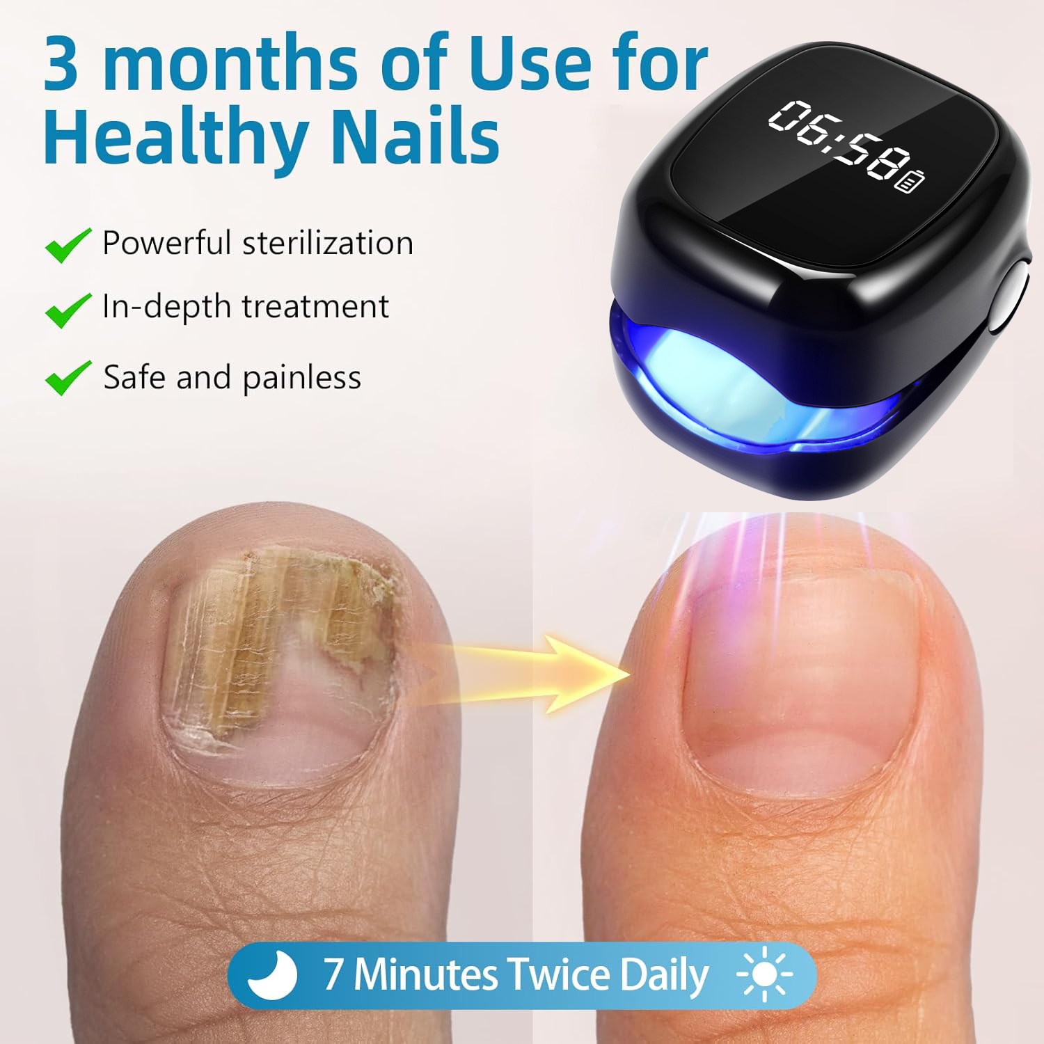 UV Laser Nail Fungus Removal D - Uv Nail Lamp ulasan dan harga