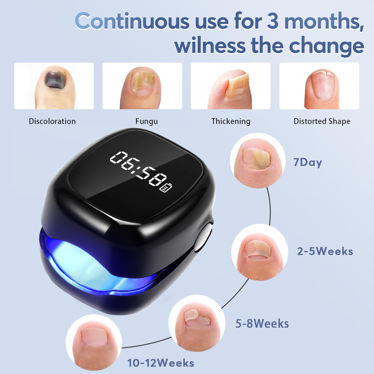 UV Laser Nail Fungus Removal D - Uv Nail Lamp ulasan dan harga