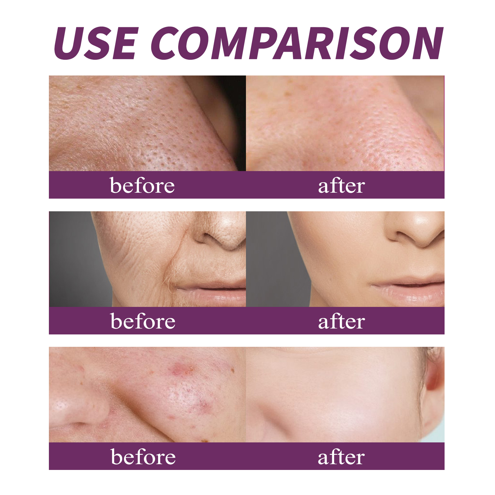 20% Niacinamide B3 Concentrate - Anti-Aging Face Cream ulasan dan harga
